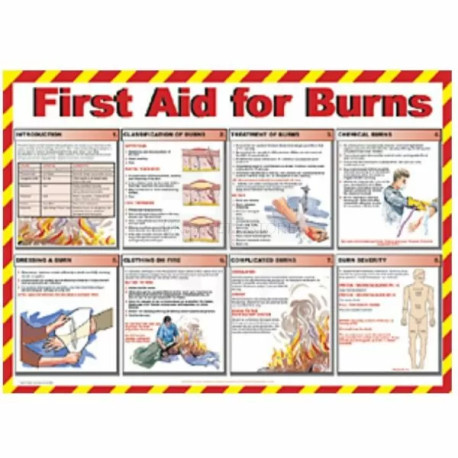 First Aid For Burns Laminated Poster