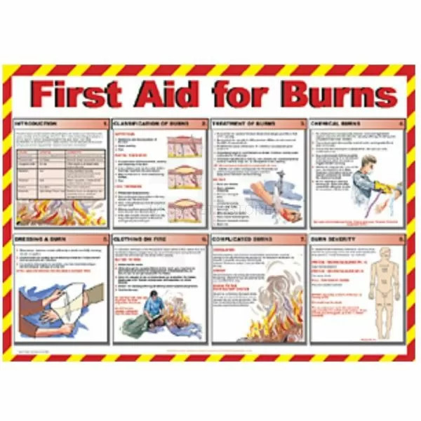 First Aid For Burns Laminated Poster
